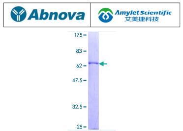 说明书丨Abnova艾美捷CD5L（人）重组蛋白（P01）