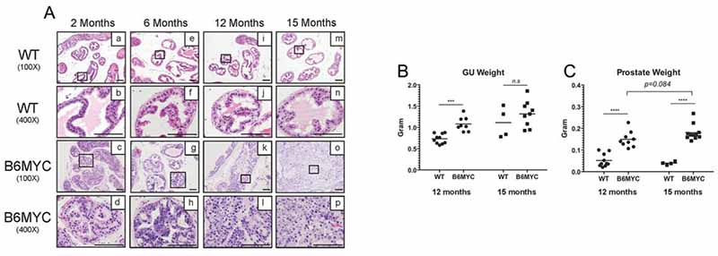 建立C57BL/6 背景的MYC诱导的前列腺肿瘤的小鼠模型和细胞系