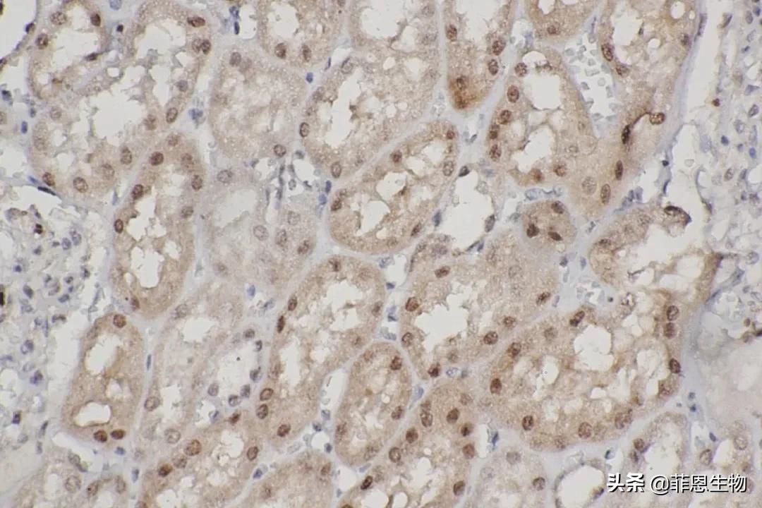 免疫组化基础（1）—如何标准化新免疫组化法