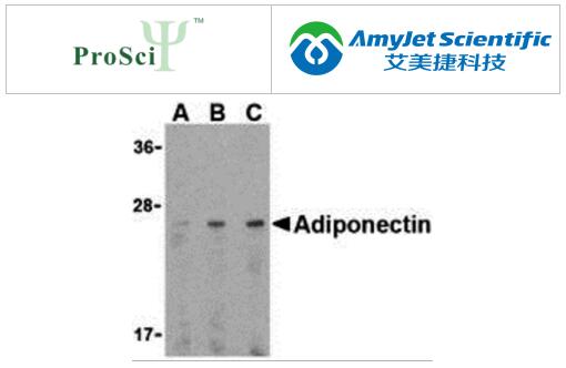 艾美捷脂肪因子研究:ProSci脂联素和CTRPs 1-7检测套装 艾美捷脂肪因子研究:ProSci脂联素和CTRPs 1-7检测套装