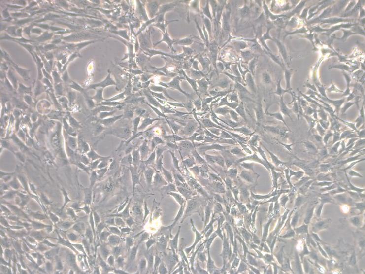 3T3-L1细胞培养及经典“鸡尾酒”诱导攻略