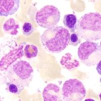 类器官全外显子组测序(WES)