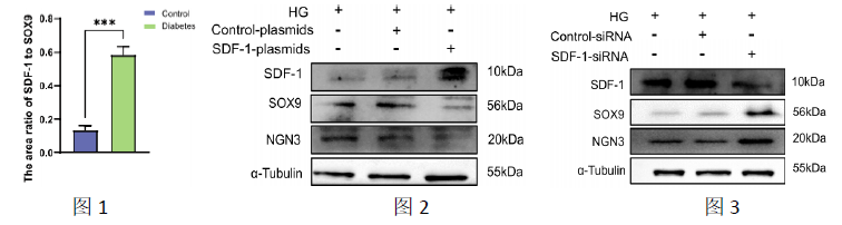 爱必信多色文献解读：糖尿病治疗新靶点——SDF-1