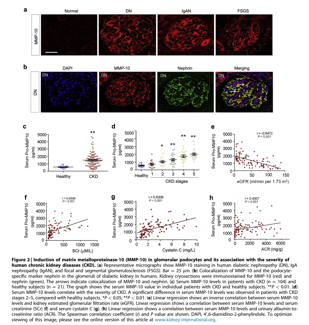 MMP10-新的足细胞损伤介导分子