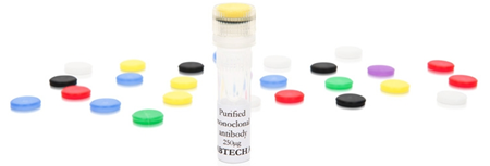 抗人白细胞介素-17A艾美捷丨Mabtech方案来啦