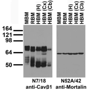 NeuroMab抗钙通道抗体(N7/18)正在促销中 NeuroMab抗钙通道抗体(N7/18)正在促销中