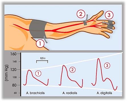 volume clamp illustration