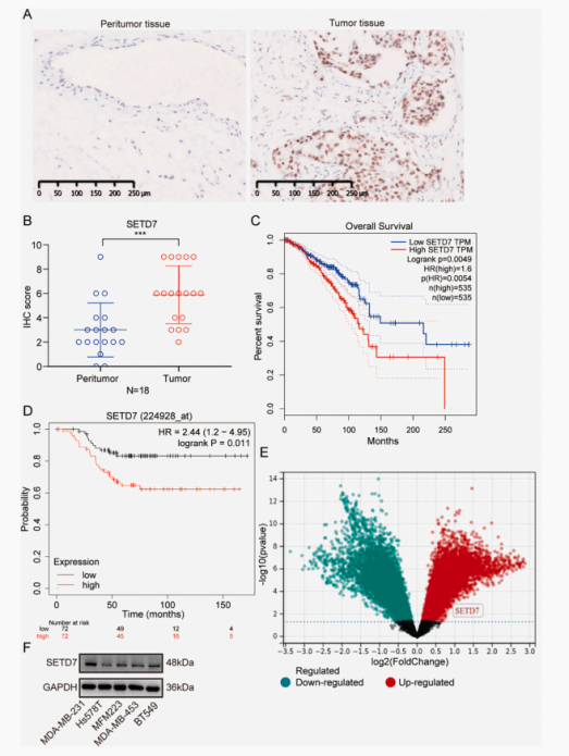 【IF 6.2】艾迪基因KO细胞解码SETD7调控TNBC细胞迁移和EMT过程机制
