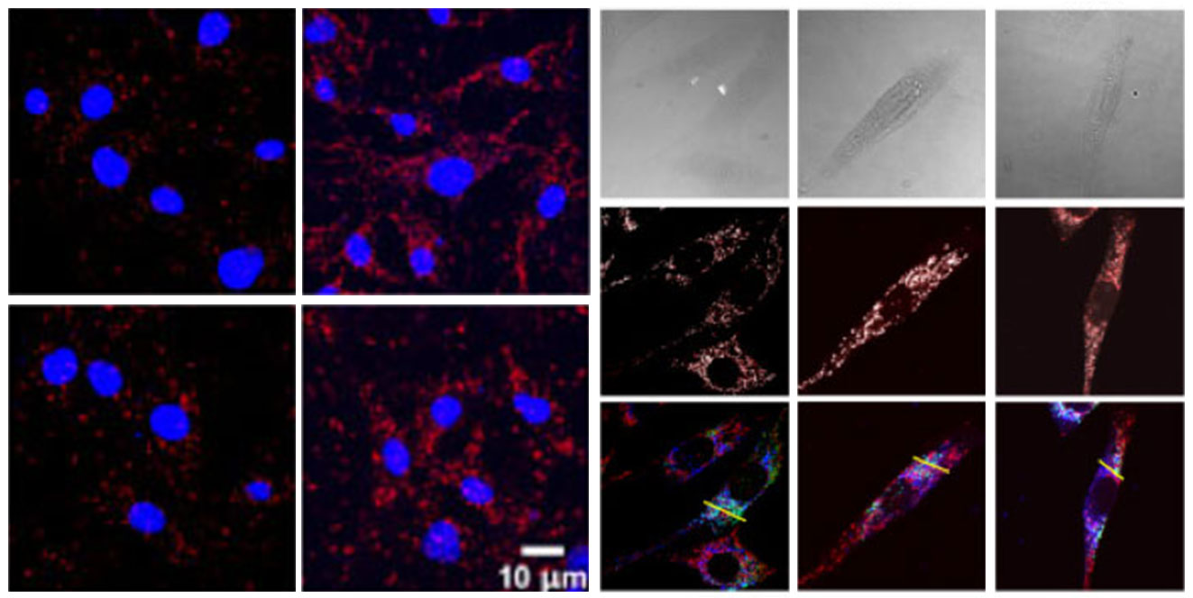 TRPC1 和 TRPC6：驱动内毒素血症的心脏功能障碍