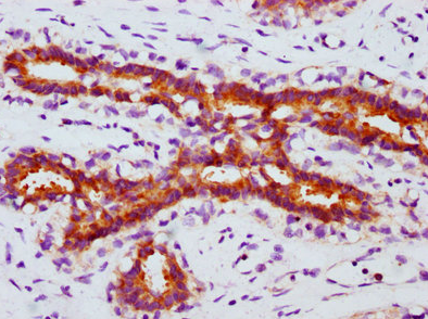 Epigentek-磷酸化FOXO3（S253）重组单克隆抗体[1E1]超值优惠来袭