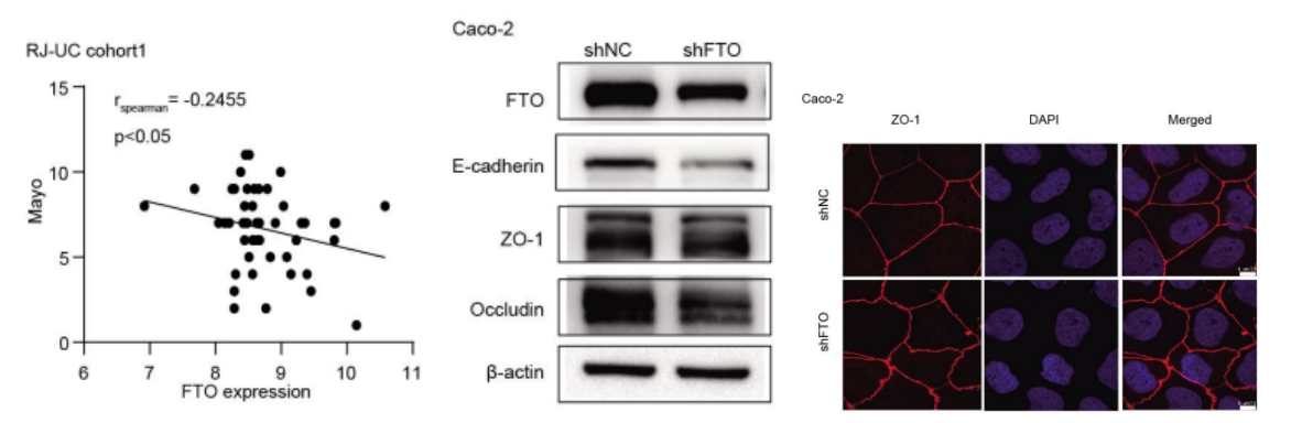 文献解析 | m6A修饰去甲基化酶FTO与溃疡性结肠炎