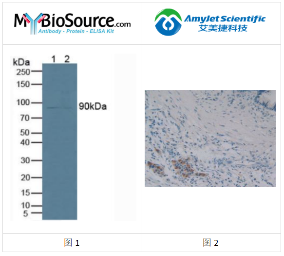 Mybiosource丨Mybiosource兔抗人磷脂酶 A2 多克隆抗体