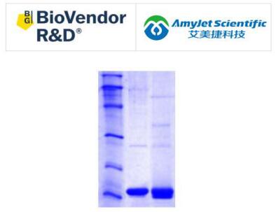 BioVendor艾美捷脑脂肪酸结合蛋白人大肠杆菌参数说明 BioVendor艾美捷脑脂肪酸结合蛋白人大肠杆菌参数说明
