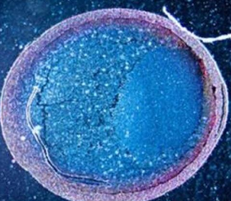 研究发现胎盘间充质干细胞能用于治疗新冠肺炎相关器官衰竭