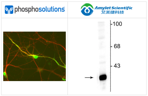 PhosphoSolutions抗DARPP-32抗体解决方案 PhosphoSolutions抗DARPP-32抗体解决方案