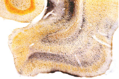 艾美捷FD NeuroSilver退化神经元银染试剂盒II方案 艾美捷FD NeuroSilver退化神经元银染试剂盒II方案