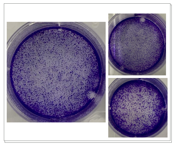 实验 | 细胞增殖检测-软琼脂克隆实验   