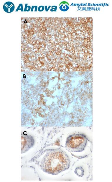 Abnova丨BSG 单克隆抗体中英文说明 Abnova丨BSG 单克隆抗体中英文说明
