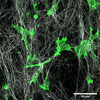 ibidi解决方案|3D细胞培养与类器官模型的构建