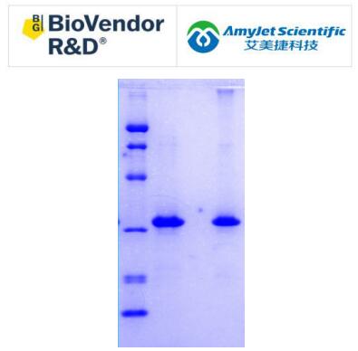 BioVendor 艾美捷 EBV EBNA-1 大肠杆菌说明书 BioVendor 艾美捷 EBV EBNA-1 大肠杆菌说明书