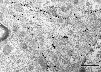 Nanoprobes 艾美捷高密度可靠的预包埋Nanogold标记 Nanoprobes 艾美捷高密度可靠的预包埋Nanogold标记