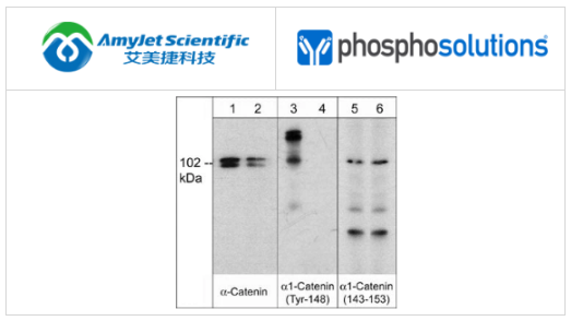 PhosphoSolutions抗α1-连环蛋白(N末端区域)抗体解决方案 PhosphoSolutions抗α1-连环蛋白(N末端区域)抗体解决方案