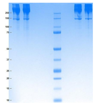 Athens-载脂蛋白B，科研必备试剂低价来袭！