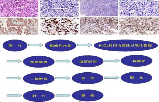 技术文章：五色染色法结缔组织染色试剂盒