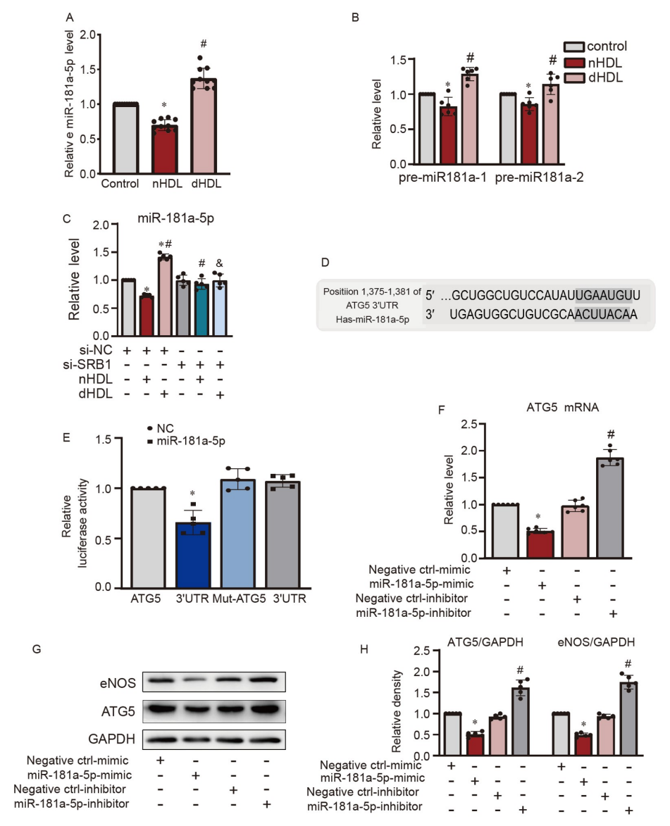 文献解读 | 高密度脂蛋白通过miR-181a-5p调控自噬影响血管新生