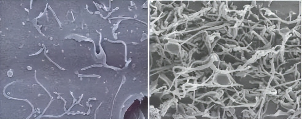 培养中常出现一些黑点，是污染吗？