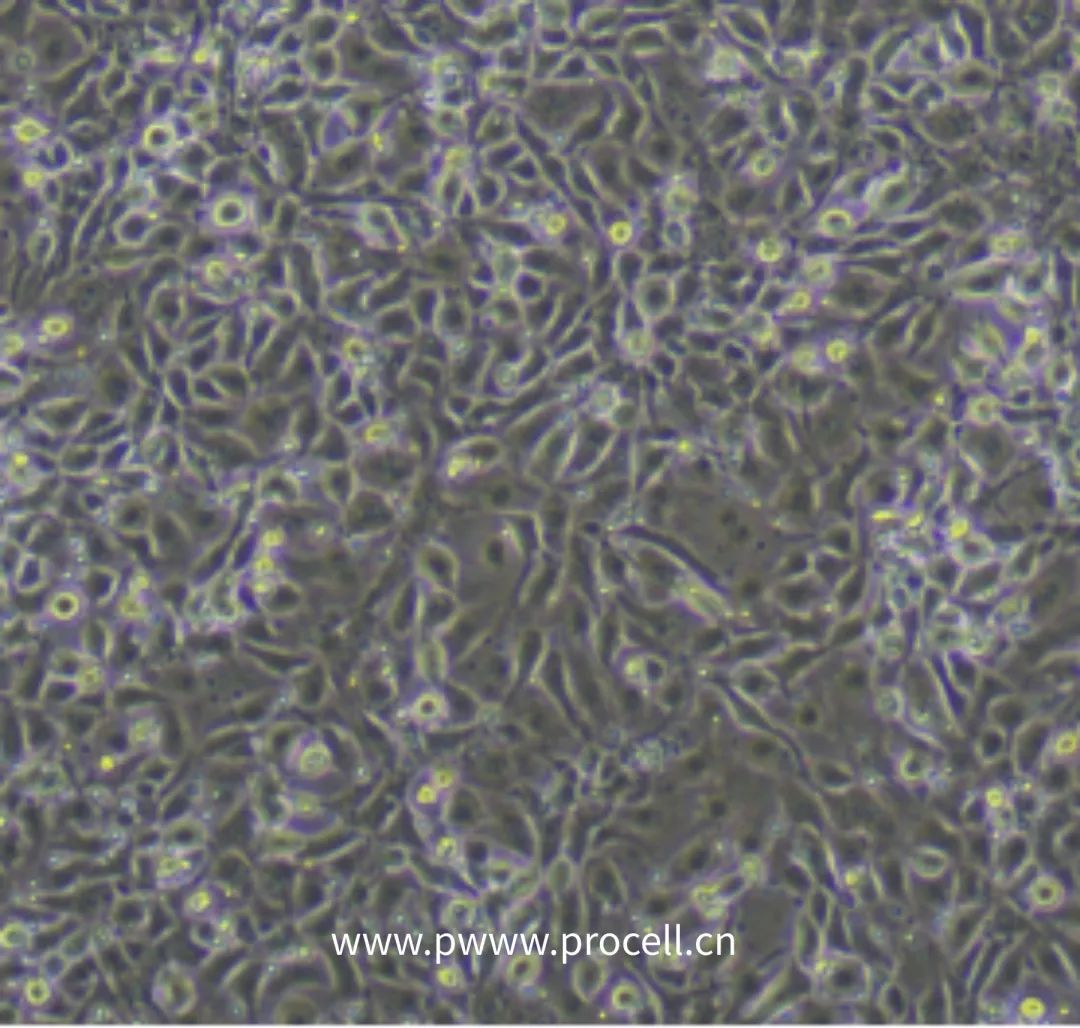 细胞学堂 | 微血管内皮细胞知识盘点