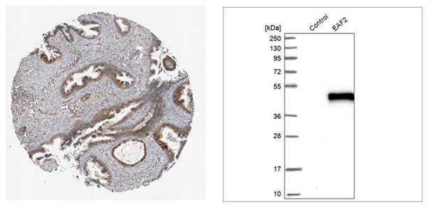 艾美捷 Atlas Antibodies公司对于宫颈癌标志物的研究方案