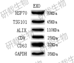 外泌体WB检测.png 外泌体WB检测.png