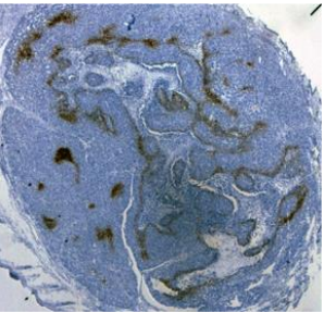 Hypoxyprobe/艾美捷Hypoxyprobe-1 Plus Kit正在促销中 Hypoxyprobe/艾美捷Hypoxyprobe-1 Plus Kit正在促销中