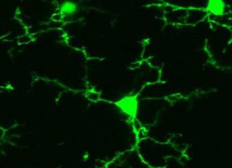 LANDO的缺乏加上衰老会导致阿尔茨海默氏病的发生
