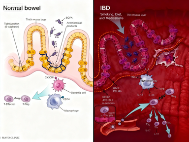 多因子检测技术在肠道炎症疾病研究中的应用与进展
