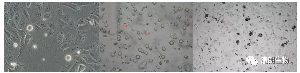 在细胞培养过程中有小黑点怎么办？