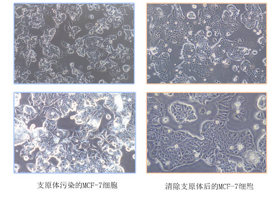 细胞出现支原体污染产生的影响和清除服务有哪些?