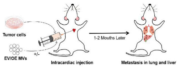 图5. 为确定PFN1在肿瘤转移中的作用而建立的转移瘤小鼠模型示意图