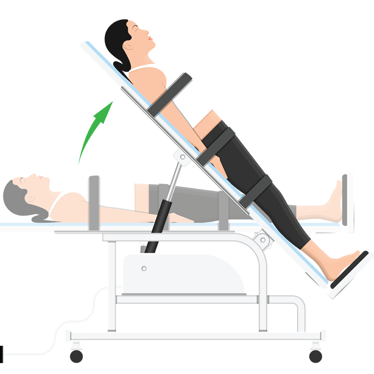 应用完全植入式 Kaha 植入子的前沿研究