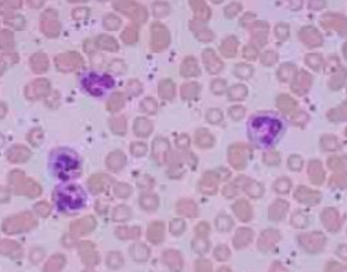 中性粒细胞和巨噬细胞吞噬功能检测