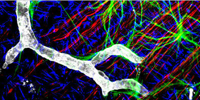 Jackson丨艾美捷Jackson多重标记可同时检测多个目标
