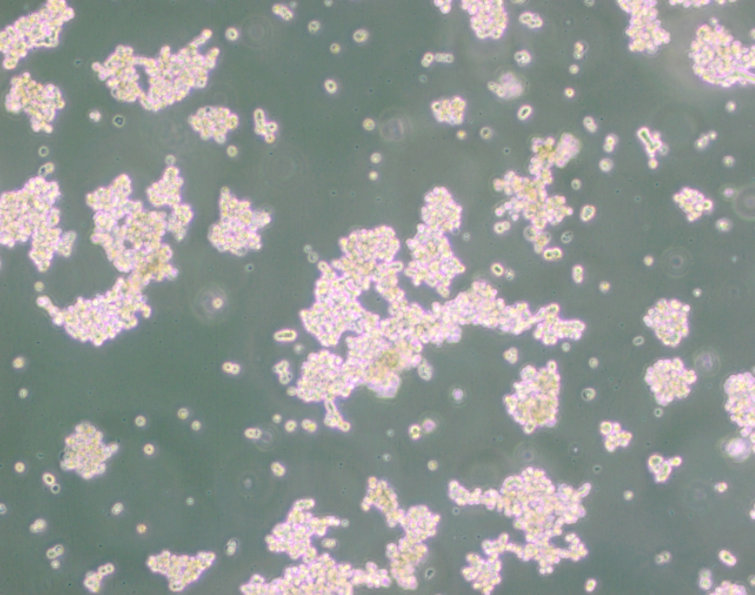 PC-12细胞未分化、低分化、高分化的区别及应用