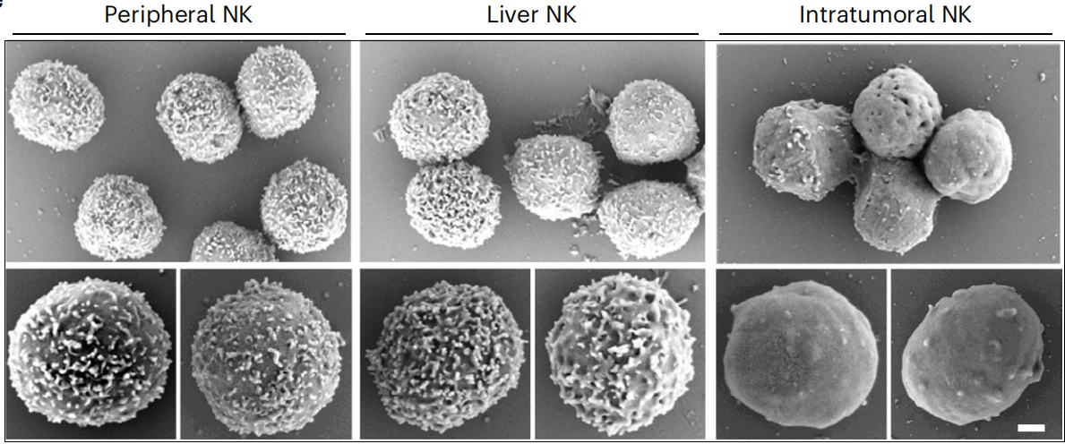 干货分享 | 肿瘤与巨噬细胞共培养方案