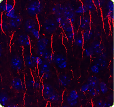 Antibodies Incorporated--高品质神经学抗体供应商 Antibodies Incorporated--高品质神经学抗体供应商