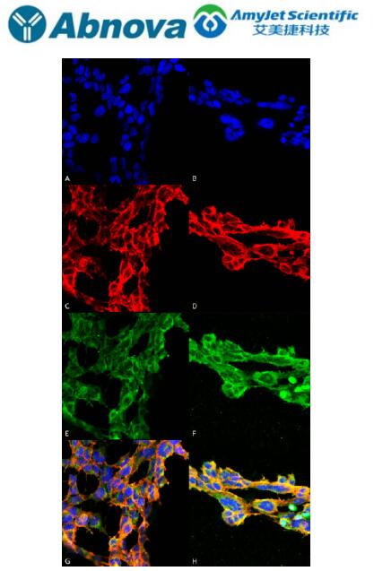 Abnova 7-酮胆固醇单克隆抗体丨免疫细胞化学应用