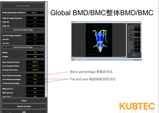 双能X射线骨密度仪及体成分分析仪预约试用啦