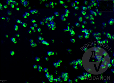 antibodies-online高亲和力重组SARS-CoV-2刺突S1抗体（RBD）促销中
