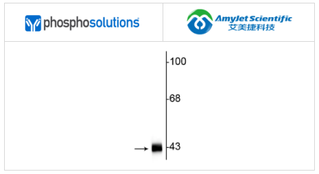 艾美捷Phosphosolutions抗肌动蛋白抗体(C4)方案 艾美捷Phosphosolutions抗肌动蛋白抗体(C4)方案