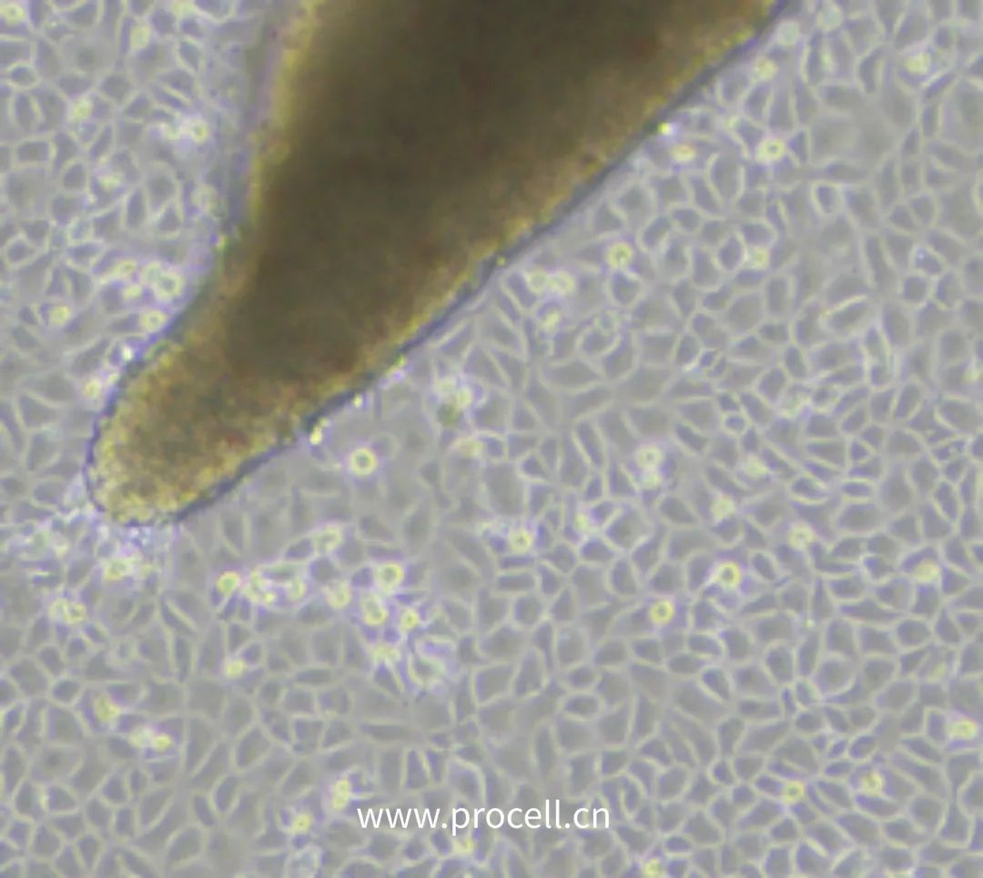 细胞学堂 | 微血管内皮细胞知识盘点
